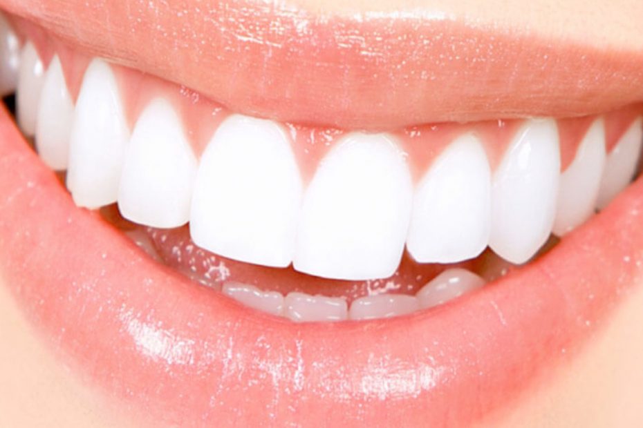 , Are you looking for a whiter brighter smile?