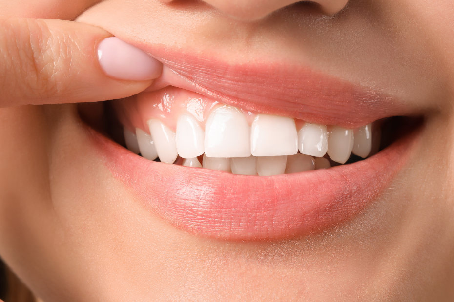 receding gums, What are the causes of receding gums?