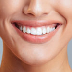 Teeth Whitening Methods