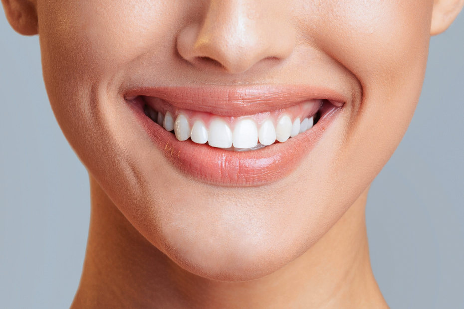 Teeth Whitening Methods