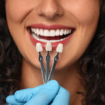 Dental Veneers Benefits Costs Featured