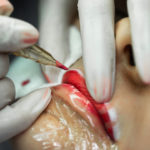 , Do Lip Tattoos Affect Oral Health? What You Need To Know