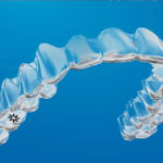 Harmful dental habits, The Benefits Of Invisalign Treatment For A Straighter Smile