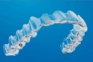 Sandhurst Dentist, home