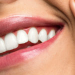 Smile Healthy Gums