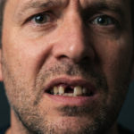 Missing tooth, What Happens If You Ignore A Missing Tooth?